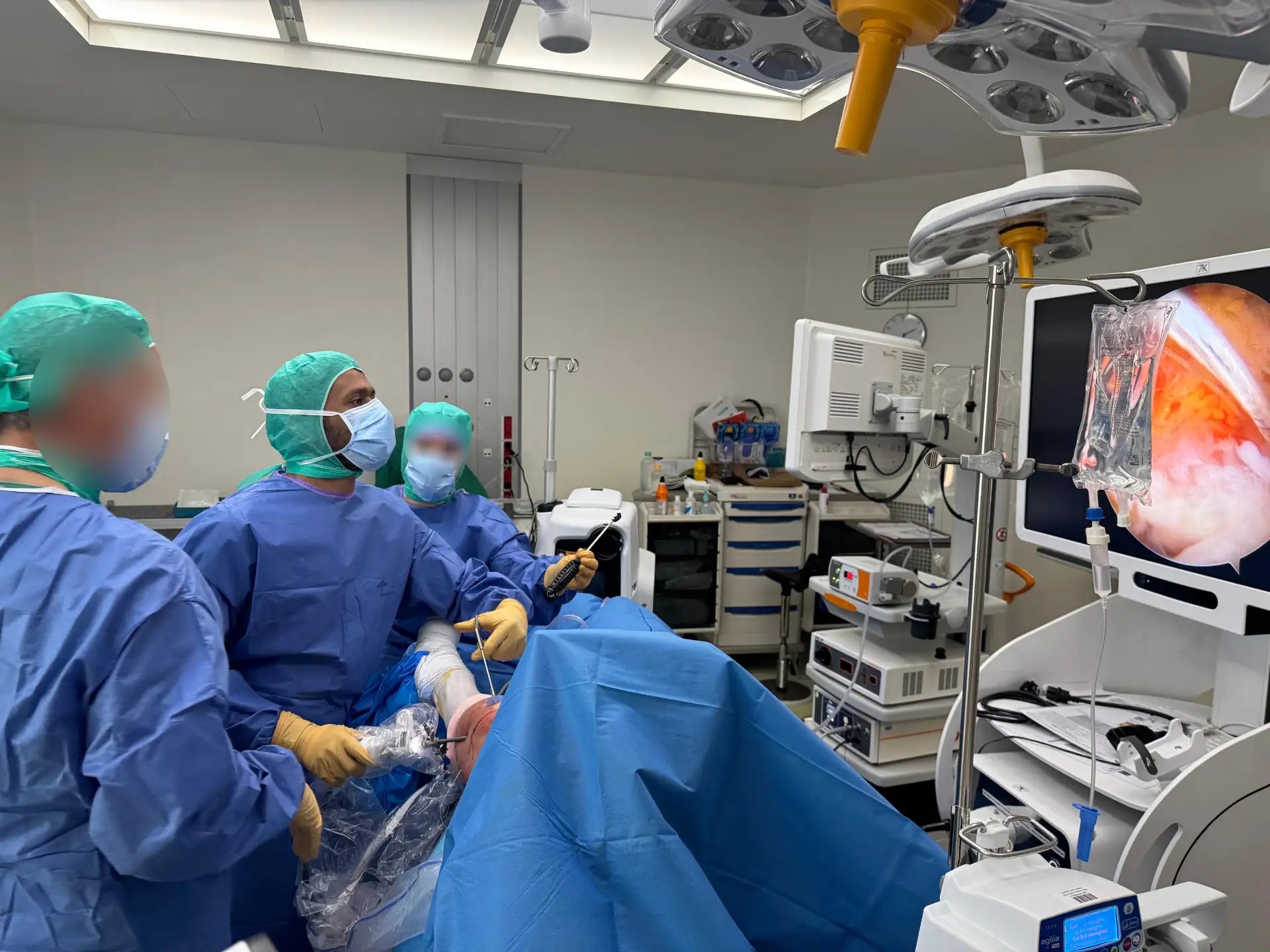 Shoulder Arthroscopy